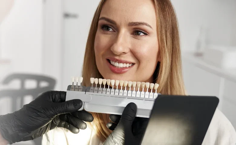 Temporary Veneers